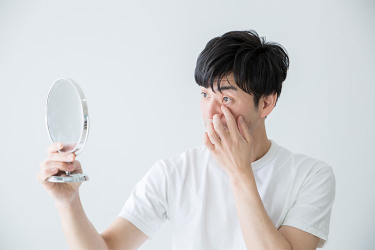 アレルギー性結膜疾患のイメージ画像
